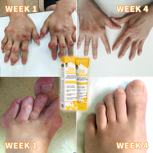 BeeSoothe™ | Arthritis & Gelenk Gel