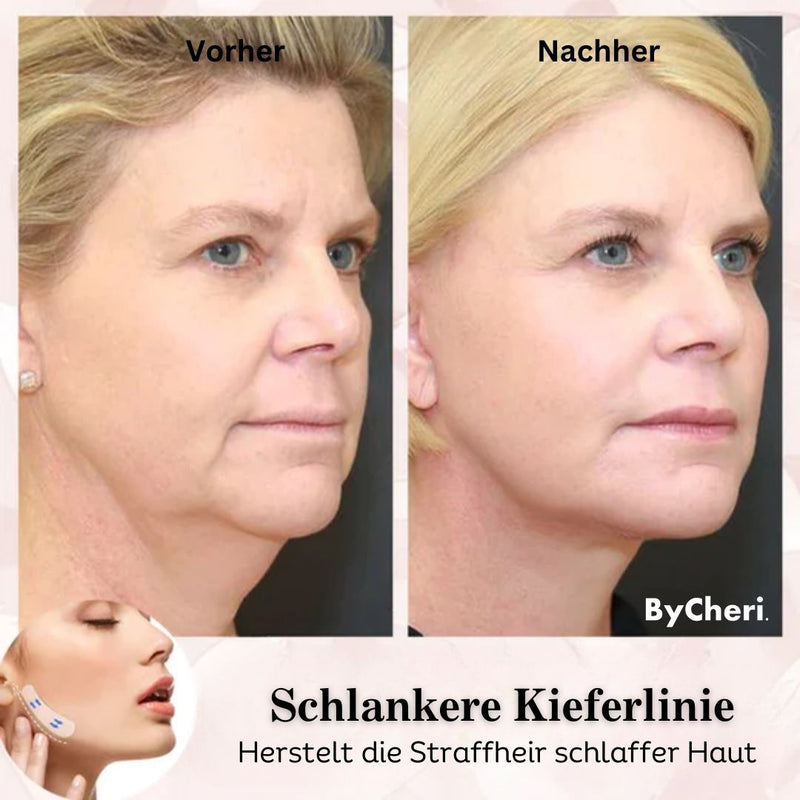 2023 Unsichtbares Facelifting-Band-Set™ - ByCheri