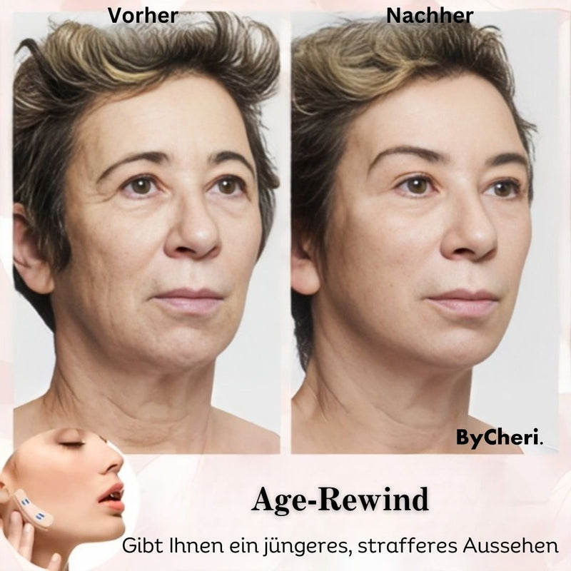 2023 Unsichtbares Facelifting-Band-Set™ - ByCheri