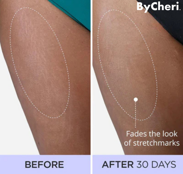 1 + 1 GRATIS HEUTE | SmoothSculpt™ | Sagen Sie Hallo zu einer sichtbar strafferen Haut!