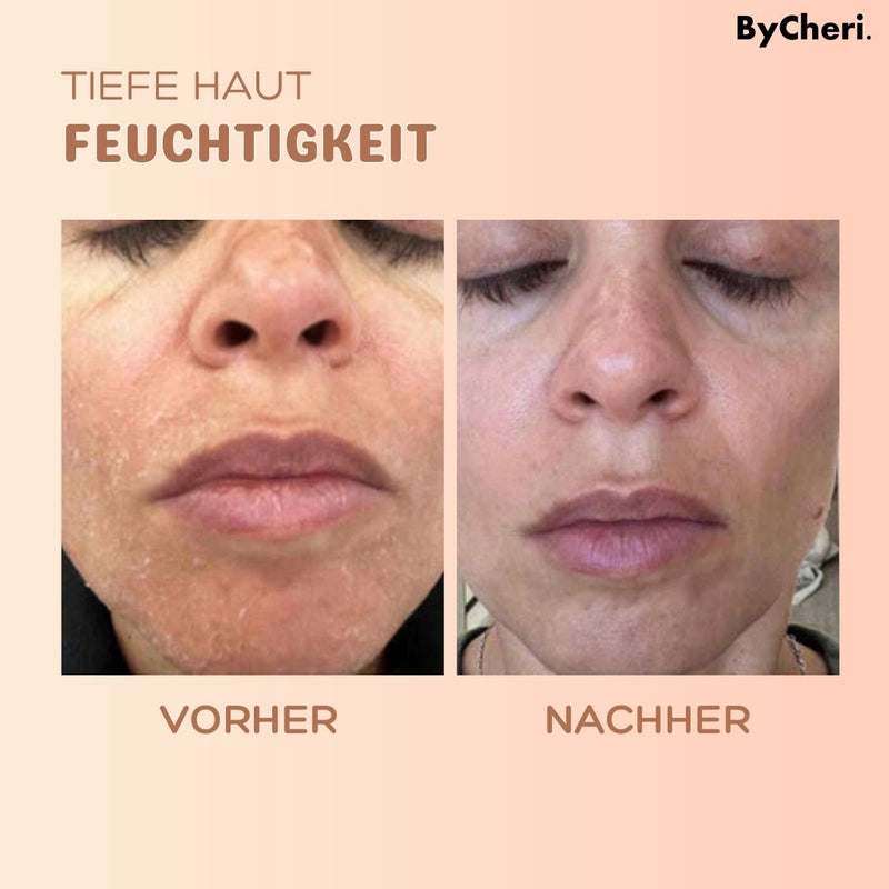 1+1 GRATIS LETZTER TAG | MultiBalm™ - Anti-Falten-Hauterneuerungsbalsam - ByCheri