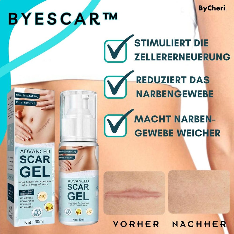 ByeScar™ - Gel zur Narbenentfernung - ByCheri