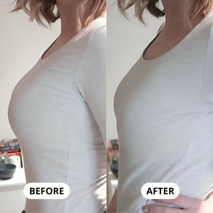 SlimFit™ | Ein BH, der Ihre Brüste sanft verkleinert!