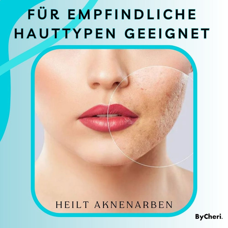 ByeScar™ - Gel zur Narbenentfernung - ByCheri