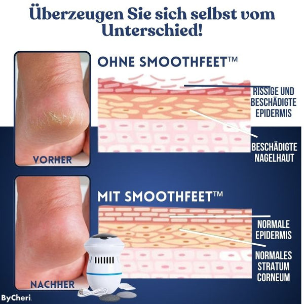 SmoothFeet™ | Erzielen Sie die glattesten Füße aller Zeiten!