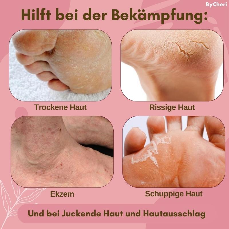 FootVitalize™ - Foot Finish Fußreparaturcreme | 1+1 GRATIS TEMPORÄR - ByCheri