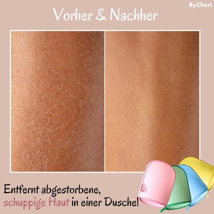 SilkySkin™ | Erzielen Sie sauberere und weichere Haut mit Ihrer Familie!