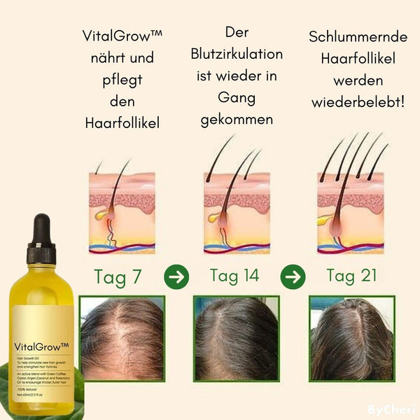 VitalGrow™ |  Ihre natürliche Ölbehandlung für Haarwachstum | 50% RABATT