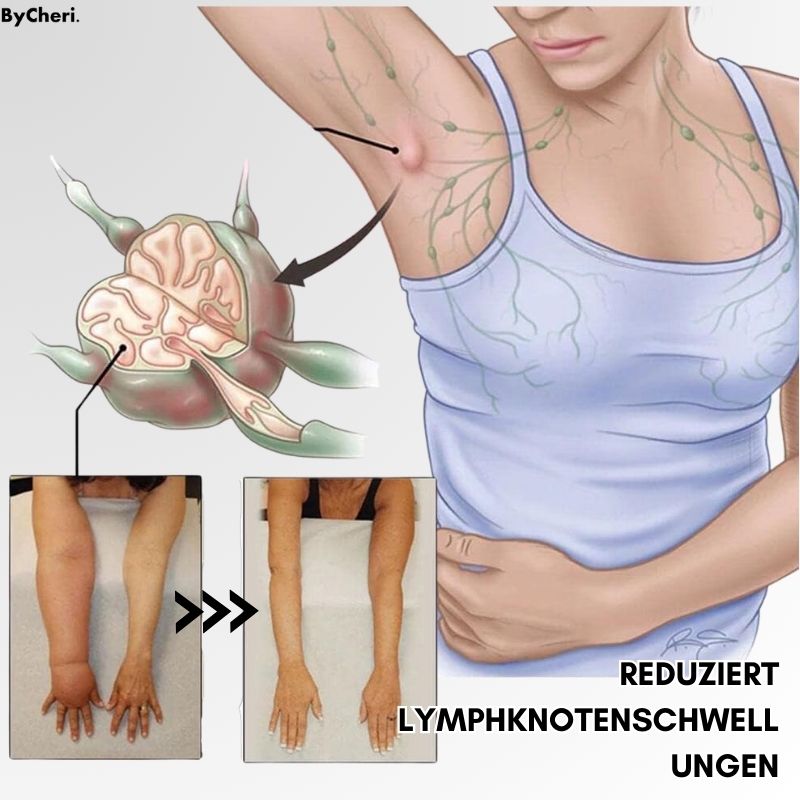 LETZTER TAG 50% RABATT | LymphMag™ | Sich in Wochen anders fühlen - ByCheri