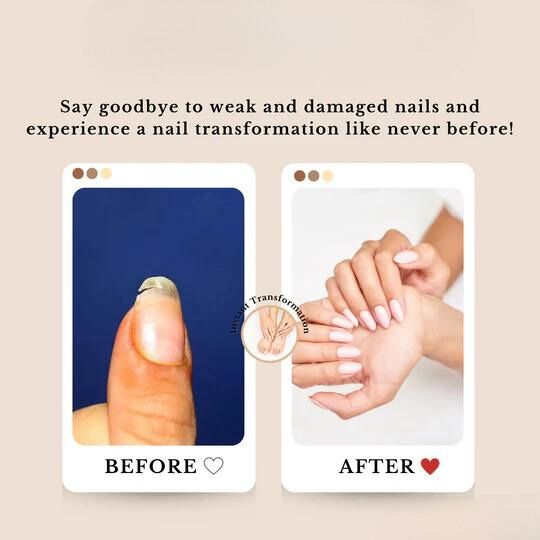 NailCare™ |  3-in-1-Nagelreparaturset