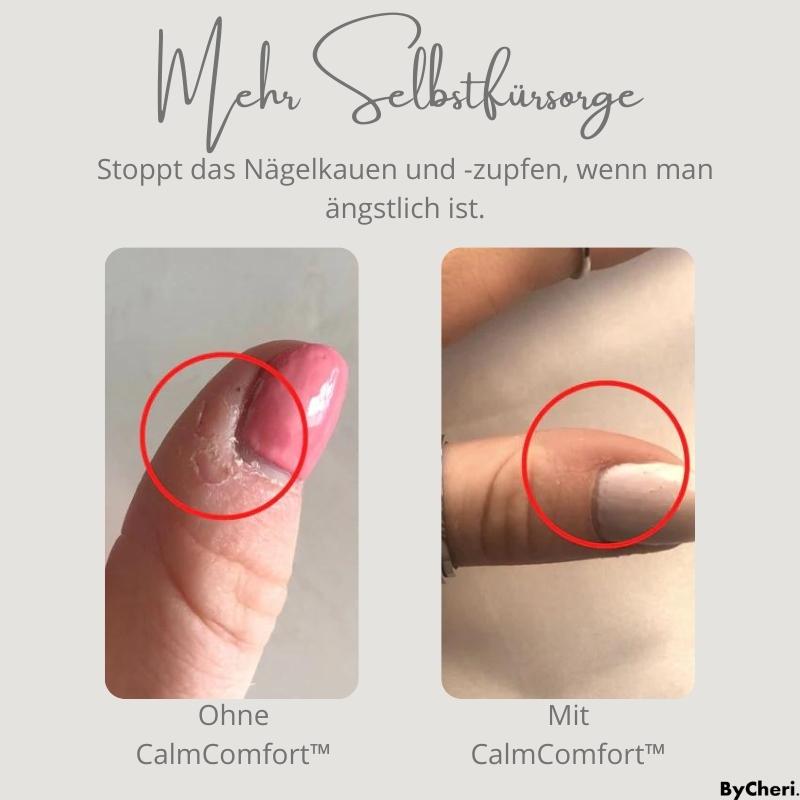 CalmComfort™ - Wulst verstellbarer Angstring | 1+1 GRATIS TEMPORÄR - ByCheri