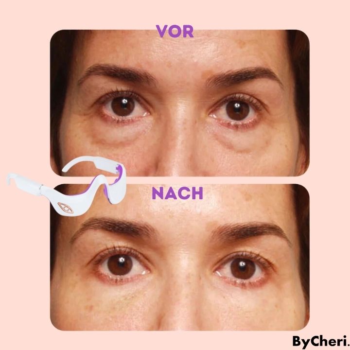 RadianceEyes™ |  Erleben Sie Augenmassage jederzeit und überall!