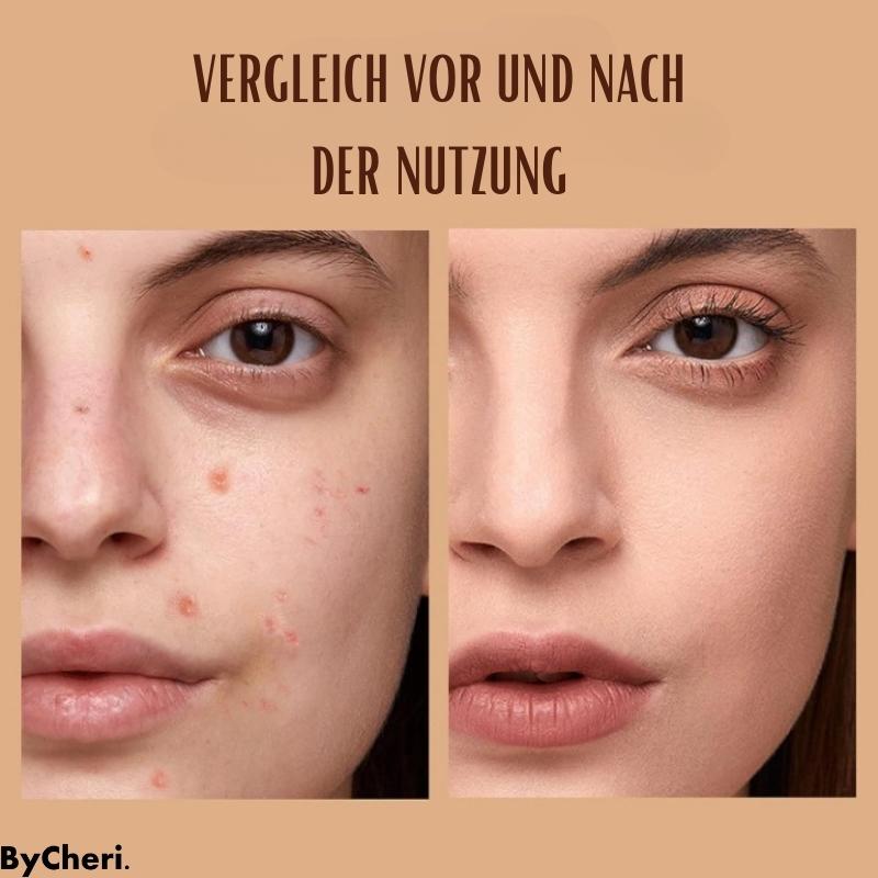 TrioTone™ - Ultimatives Gleichgewicht der Hauttöne - ByCheri