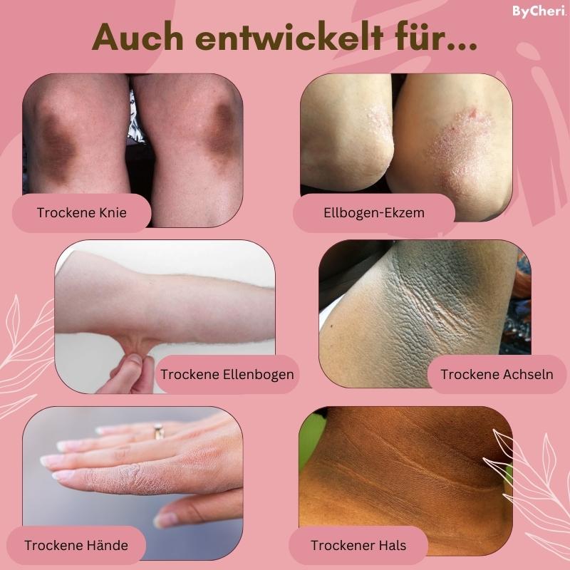 FootVitalize™ - Foot Finish Fußreparaturcreme | 1+1 GRATIS TEMPORÄR - ByCheri