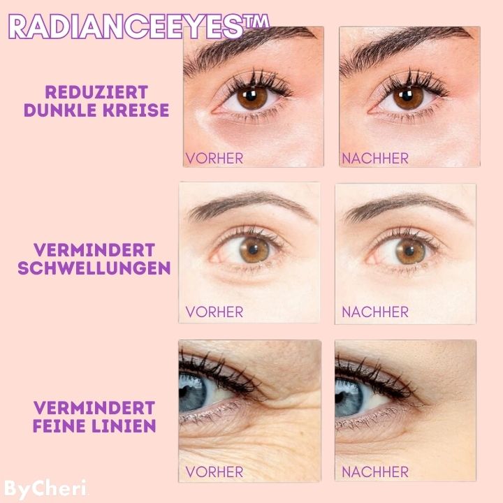 RadianceEyes™ |  Erleben Sie Augenmassage jederzeit und überall!