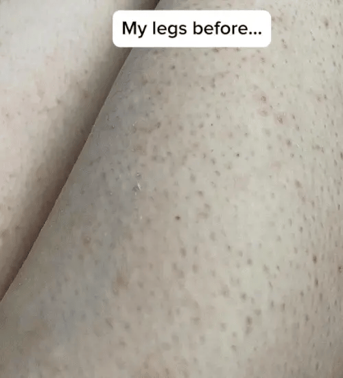 1 + 1 GRATIS HEUTE  DermaBare™ 