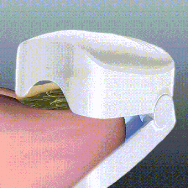 50% OFF TEMPORÄR  NailCure™