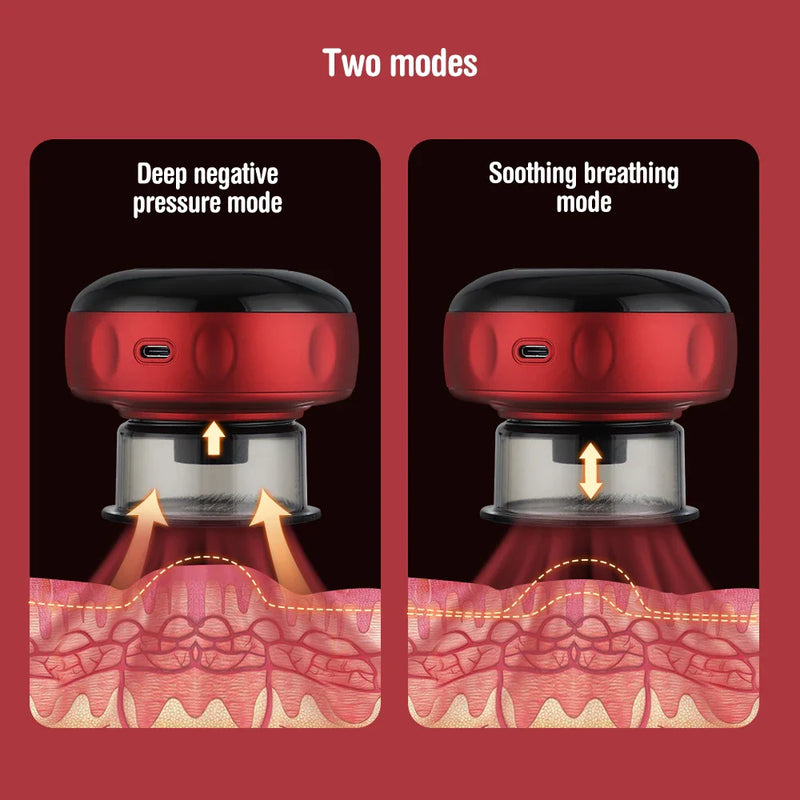 CelluSoothe™ | Elektrisches Anti-Cellulite-Schröpfmassagegerät