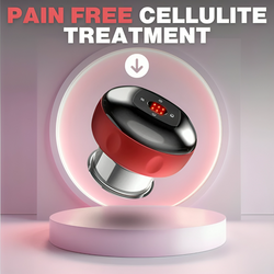 CelluSoothe™ | Elektrisches Anti-Cellulite-Schröpfmassagegerät