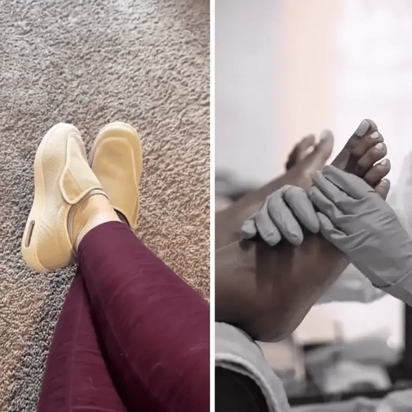 50% OFF TEMPORÄR  SoleCura™