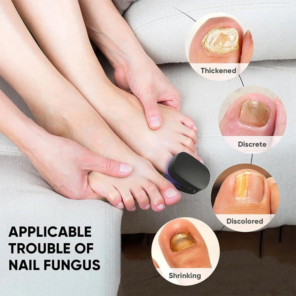 50% OFF TEMPORÄR  NailCure™