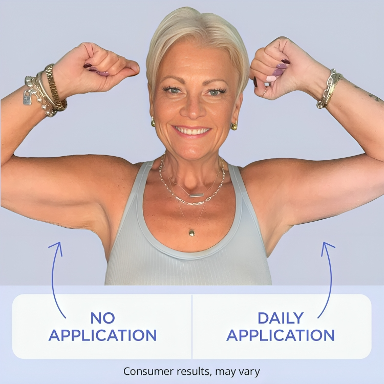 50% RABATT TEMPORÄR | SmoothSculpt™ | Sagen Sie Hallo zu sichtbar strafferen Armen!