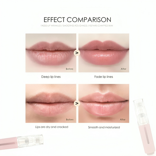 50% RABATT TEMPORÄR | LipLift™ | Erhalte volle & weiche Lippen!