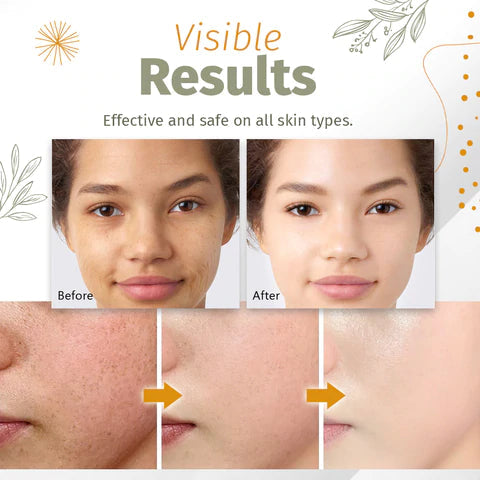 Spotless Skin Serum™- Organisches Serum zur Lösung von Hautflecken - ByCheri