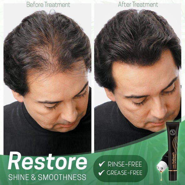 Regrowth™ Organic Hair Serum Roller - ByCheri