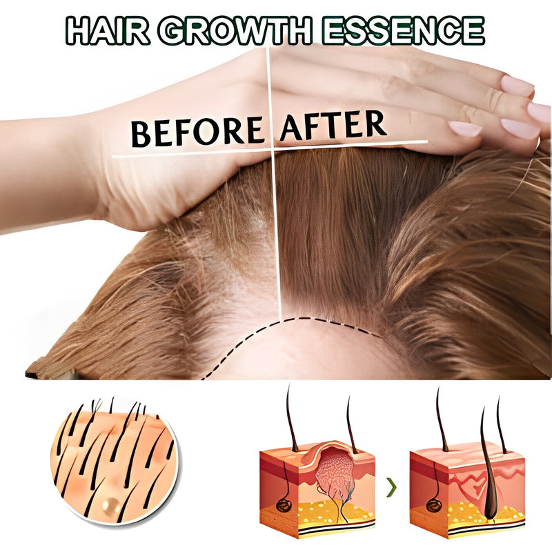 HairGrowth™ - Volleres Haar auf natürliche Weise - ByCheri