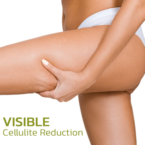 NaturLean™ - Pflaster zur Reduzierung von Cellulite - ByCheri